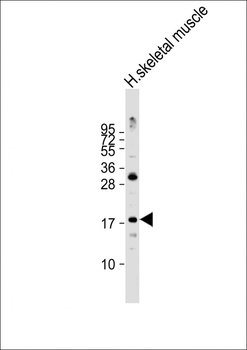 ND4L Antibody (C-term)
