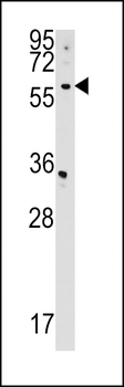 CDS2 Antibody (Center)