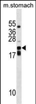 CDC42EP2 Antibody (C-term)