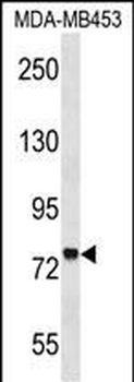 ZNF16 Antibody (N-term)