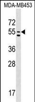 PTDSS1 Antibody (C-term)