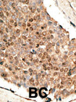 Bmp10 Antibody (N-term)