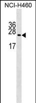 RPL10A Antibody (N-term)