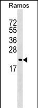ARF5 Antibody (Center)