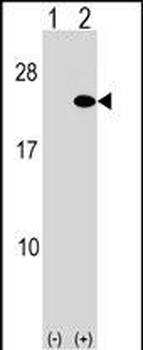 ARF5 Antibody (Center)