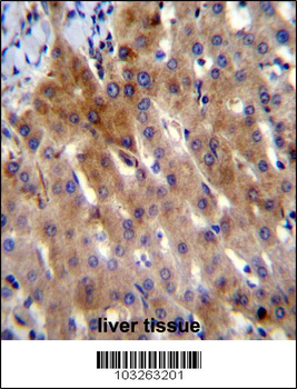 IL-17D Antibody (Center)