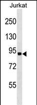 RNF10 Antibody (N-term)