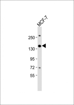 NCAPG2 Antibody (Center)