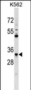 FCN1 Antibody (C-term)