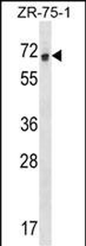 RCOR1 Antibody (N-term)