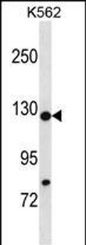 HIRA Antibody (N-term)