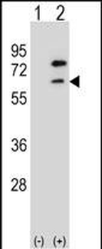 ZBTB7B Antibody (Center)