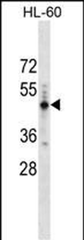 PRAMEF14 Antibody (Center)