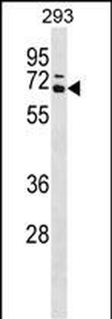 CARM1 Antibody (Center)
