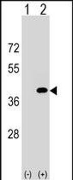 PPP1CC Antibody (C-term)