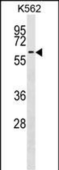 F9 Antibody (Center)