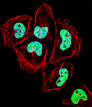 ZNF155 Antibody (C-term)
