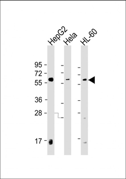 PI4K2A Antibody (C-term)