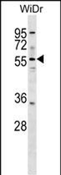 ASNS Antibody (N-term)