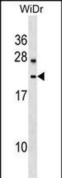 LYZL6 Antibody (Center)