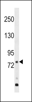 GPR149 Antibody (Center)