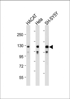 SEMA6D Antibody (N-term)