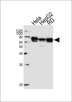 PRKAG3 Antibody (C-term)