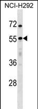 USP27X Antibody (N-term)