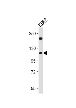 RB1 Antibody (Center S249)