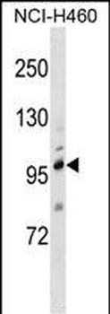TRPC1 Antibody (C-term)