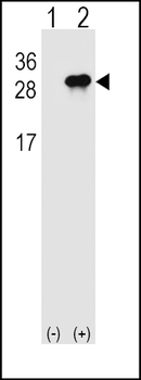 IL28B Antibody (N-term)