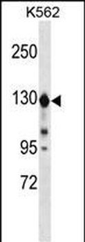 ESYT1 Antibody (C-term)