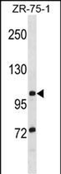 TTLL8 Antibody (N-term)