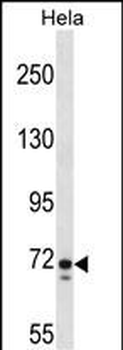 GALNT6 Antibody (C-term)