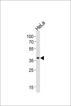 SRPX Antibody (Center)