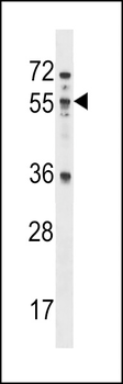 MEX3B Antibody (N-term)