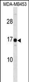 HMGN3 Antibody (N-term)