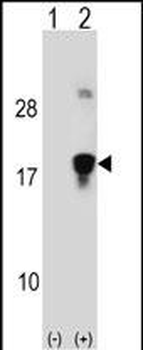 HMGN3 Antibody (N-term)