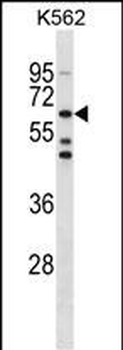 TESK1 Antibody (Center)