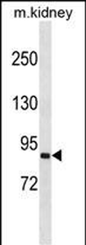 SEMA4A Antibody (N-term)