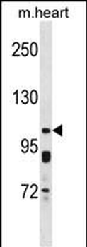 KCNQ5 Antibody (C-term)
