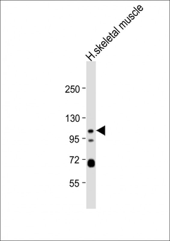 KCNQ5 Antibody (C-term)