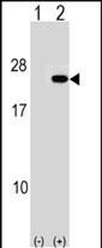 PAIP2 Antibody (N-term)