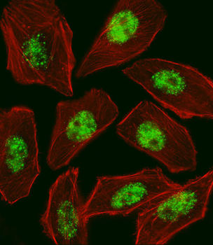RFX1 Antibody (C-term)
