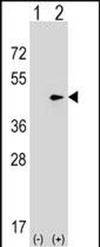 SEPT2 Antibody (C-term)