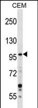 GREB1 Antibody (Center)
