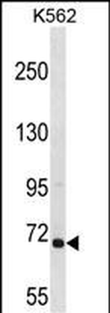 ARHGEF6 Antibody (C-term)