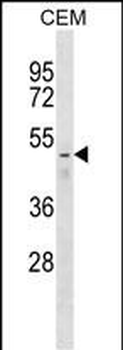 FNTB Antibody (N-term)