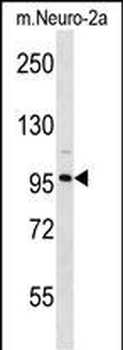 CLCN2 Antibody (N-term)