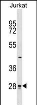 CTDSP1 Antibody (N-term)
